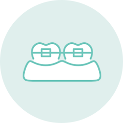 STEP 05 矯正治療開始